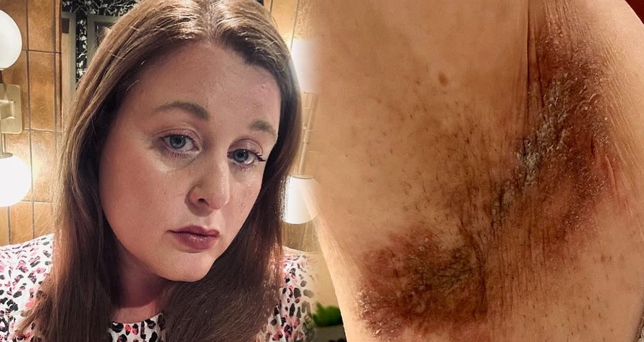 cildi yakan deodorant icin dava acildi bir kez kullandim yanma hissettim kp7U6yzP